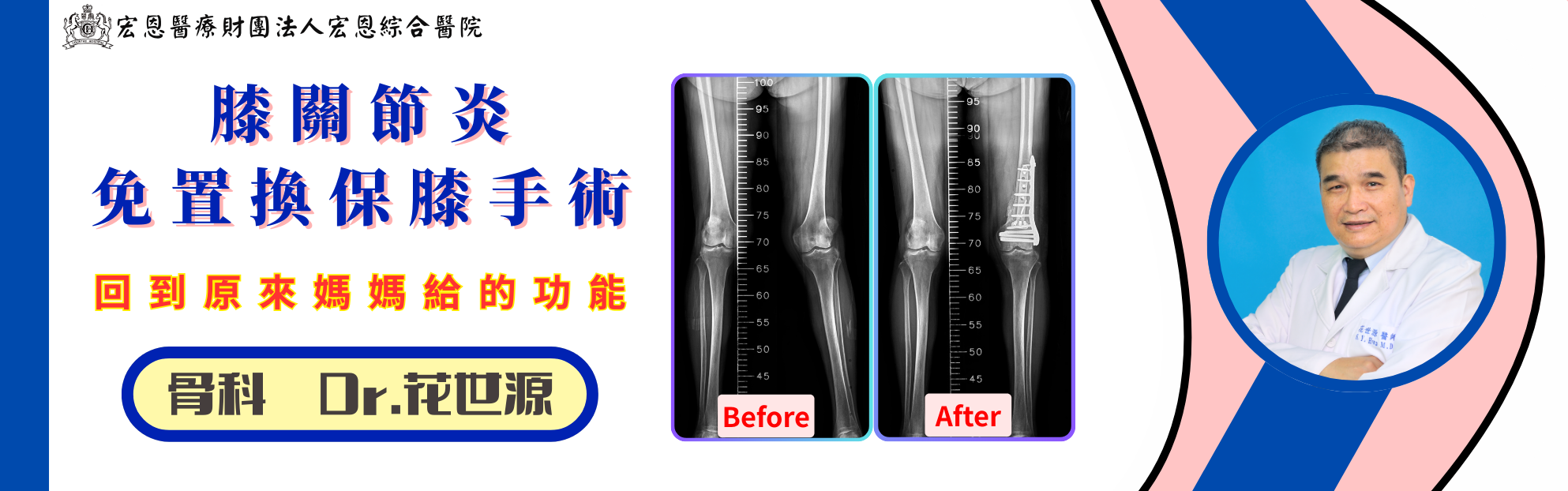 退化性關節炎專治